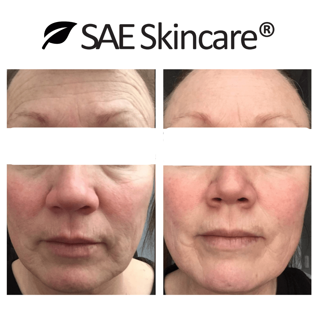 Anti - Aging Skin Brightening Set - SAE SKINCARE