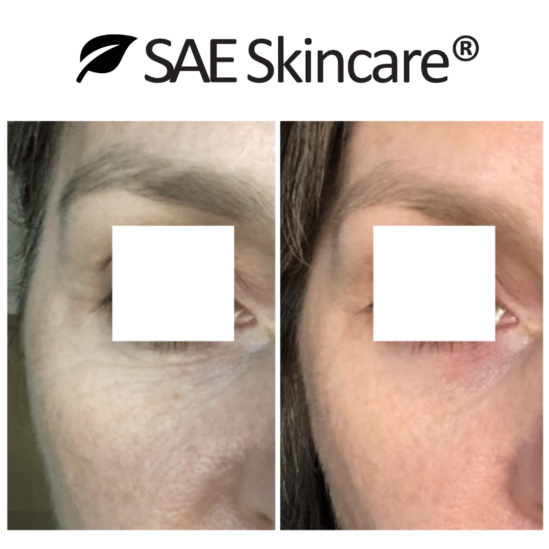 Anti - Aging Skin Brightening Set - SAE SKINCARE