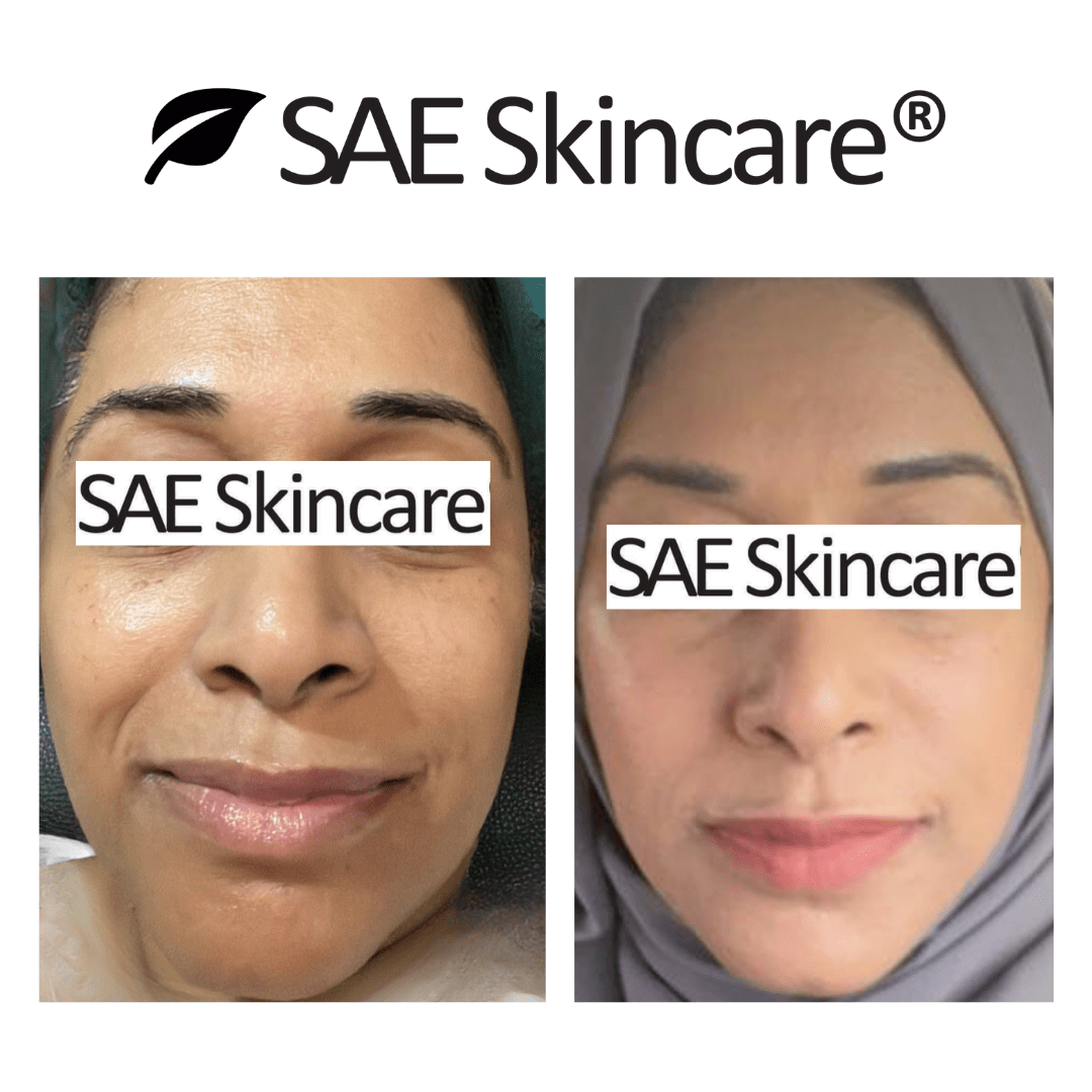 Brightening and Pigmentation Set - SAE SKINCARE
