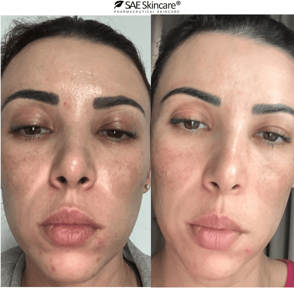 Brightening and Pigmentation Set - SAE SKINCARE