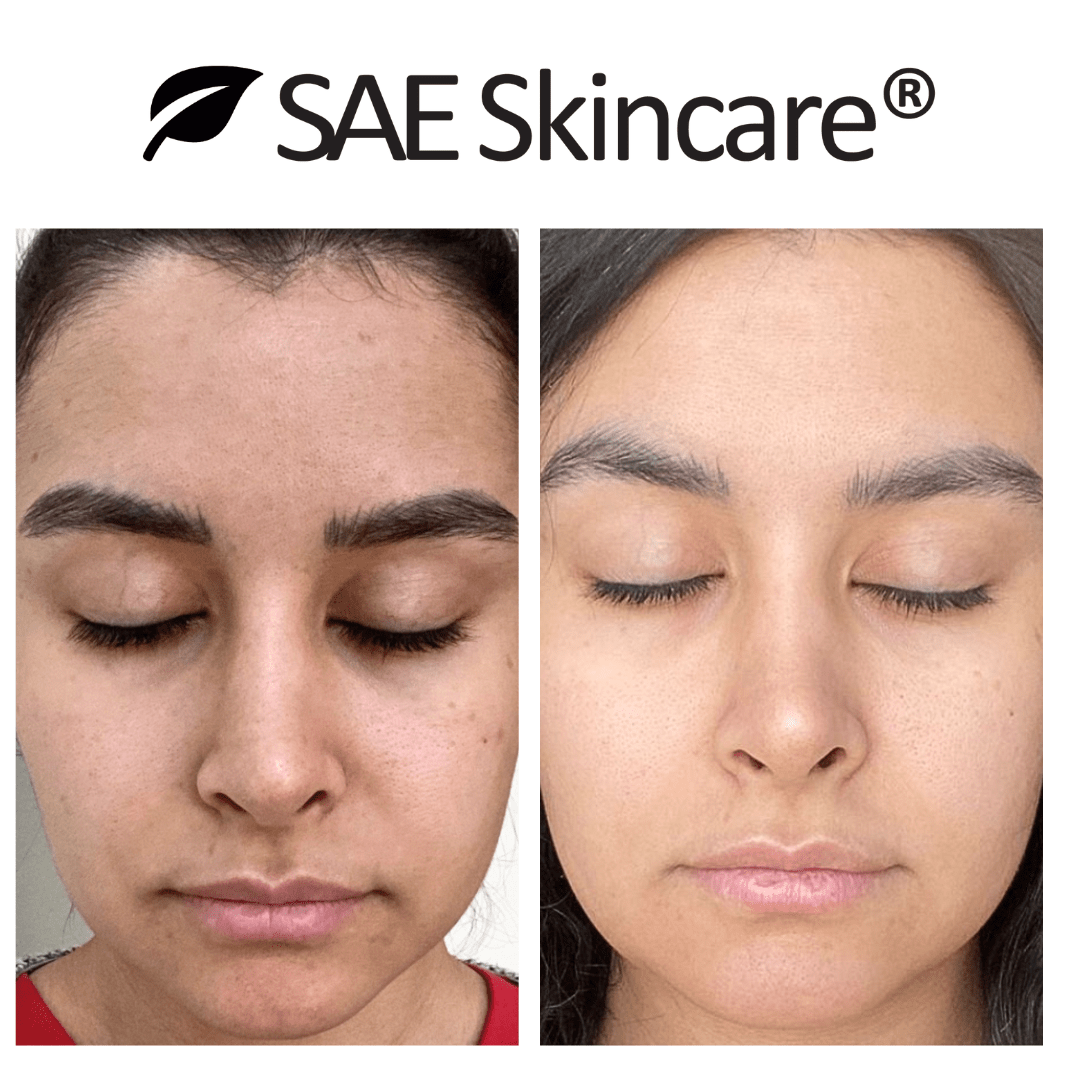 Glam & Glow Set - SAE SKINCARE