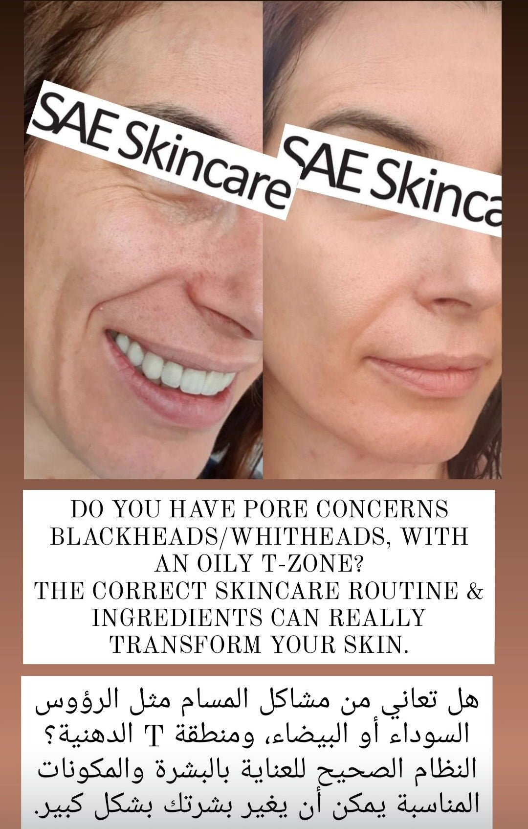 Pore Control Kit - SAE SKINCARE